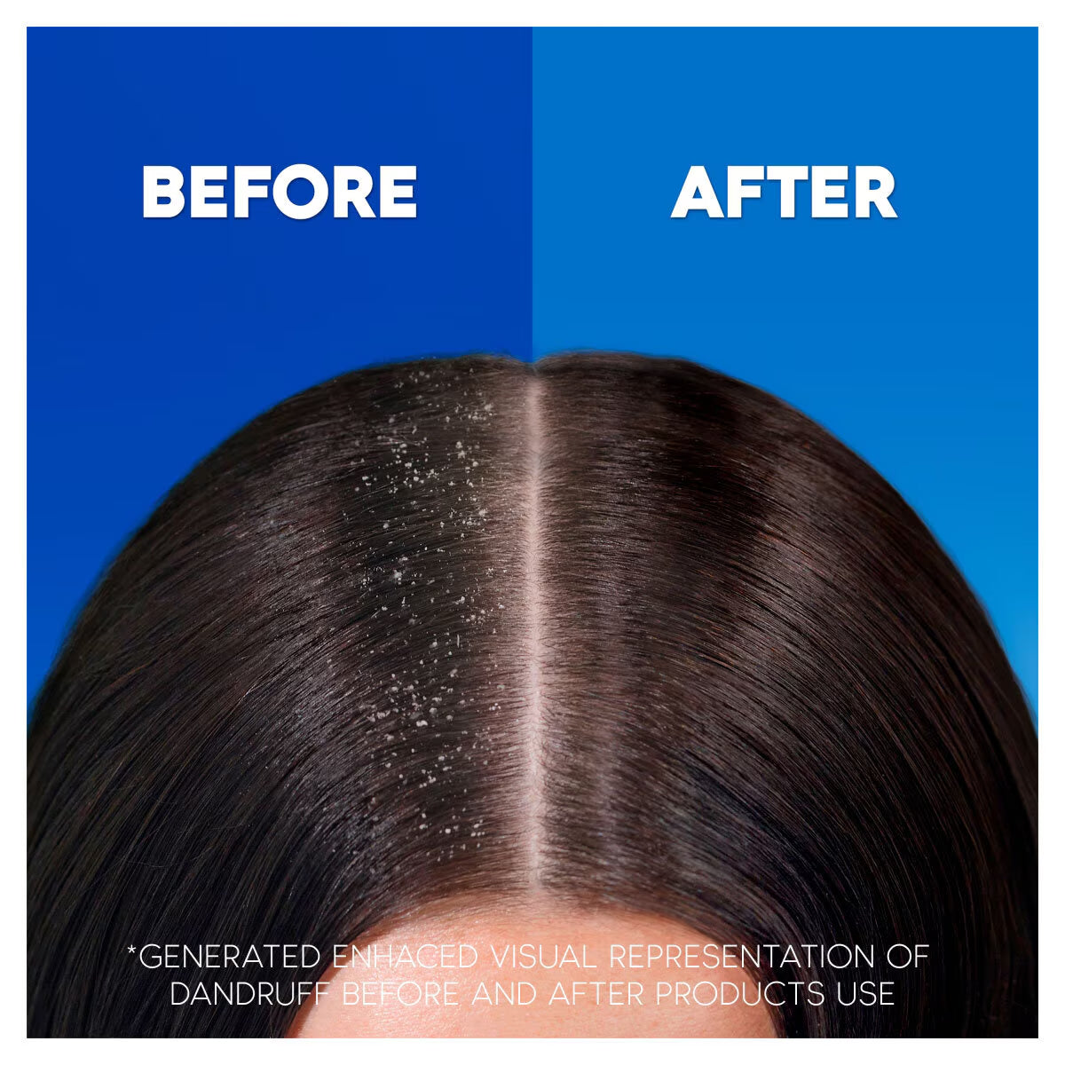 Head and Shoulders Classic Clean & Apple, 2 X 1L